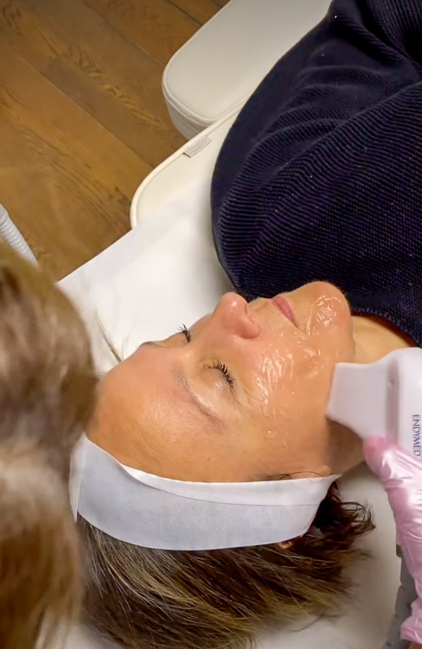 Radiofréquence visage, IG @sadaf_jaffari | Treatwell